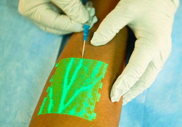 Visualizador de Veias